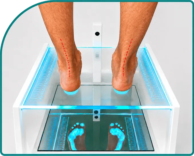 Chăm Sóc Tư Thế, 
Bàn Chân Bẹt 
& Vẹo Cột Sống Ở Trẻ